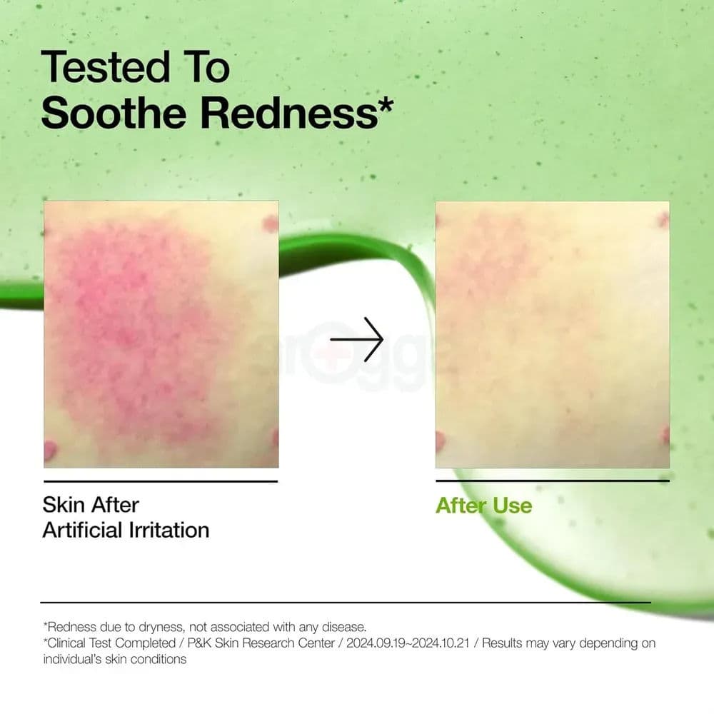 Azelaic Acid 10 Hyaluron Redness Soothing Serum 4