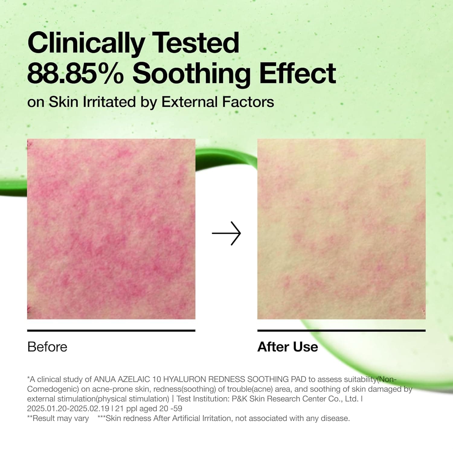 Azelaic 10 Hyaluron Redness Soothing Pad 6