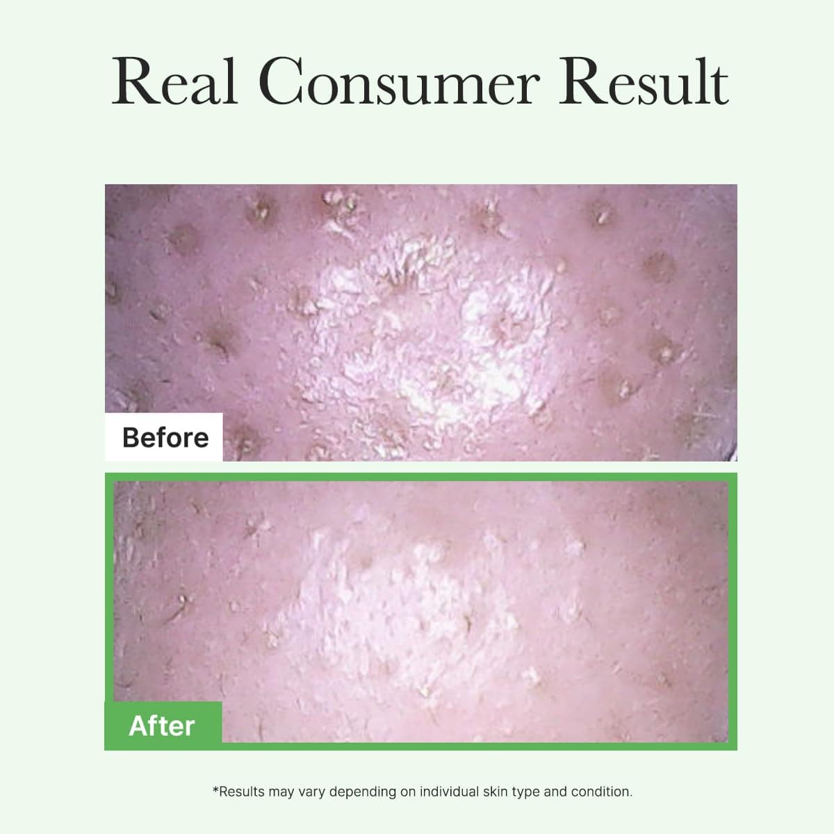 Pore Melt Mochi Cleansing Oil 7