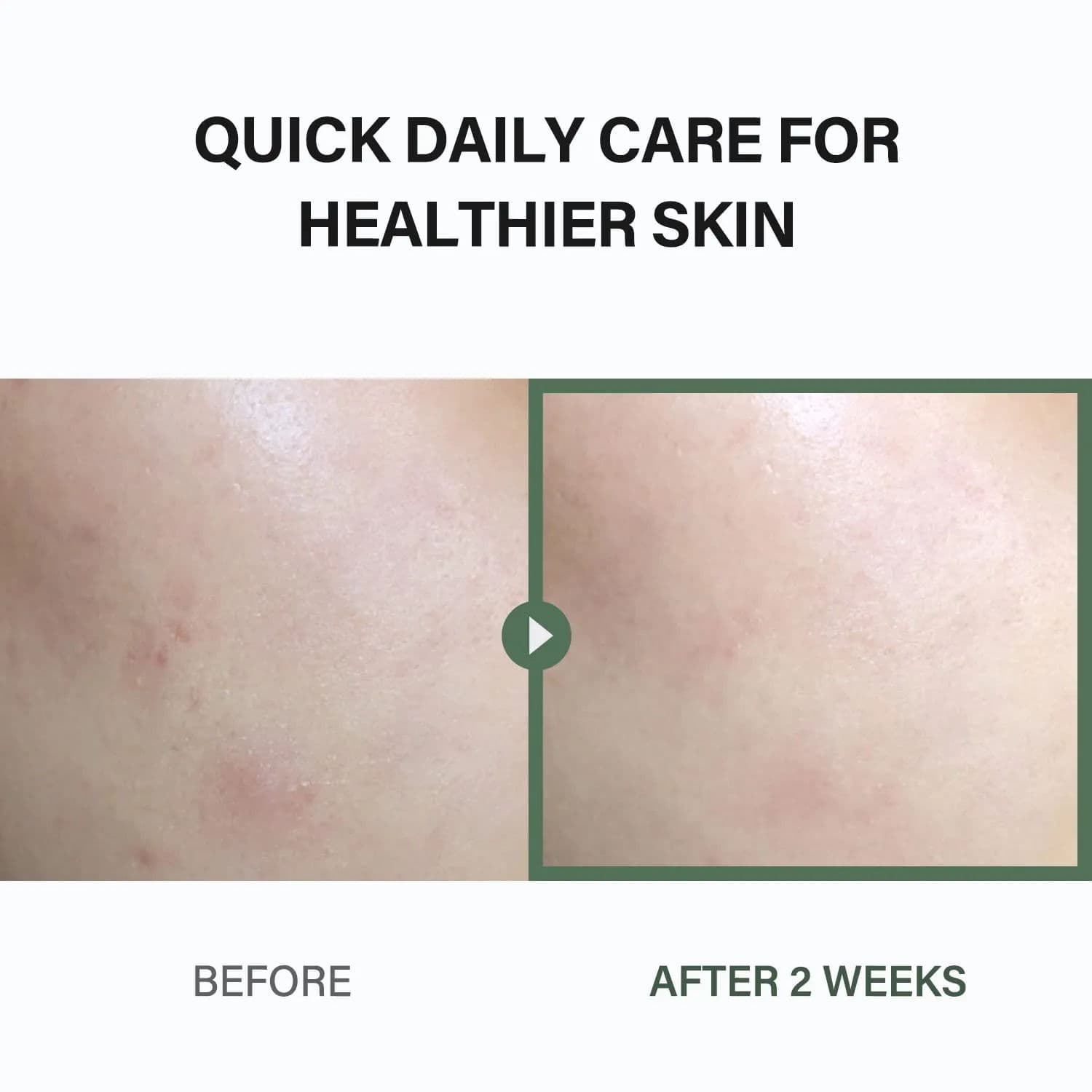 JIWOOGAE Heartleaf BHA Peeling Pad 2