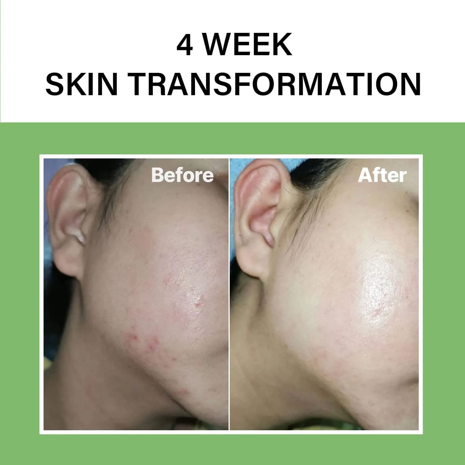 Noni Ampoule Calming + Radiance 3