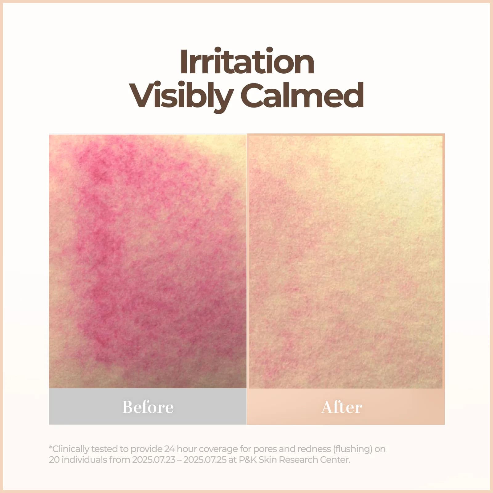 Skin Blemish Balm Intensive 5