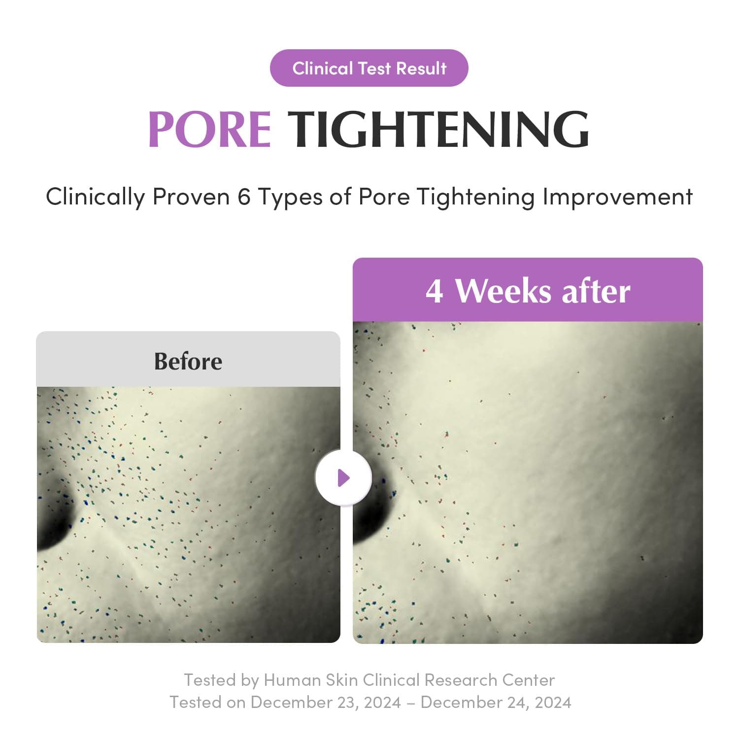 Purple PDRN Pore Minimizing Serum 4