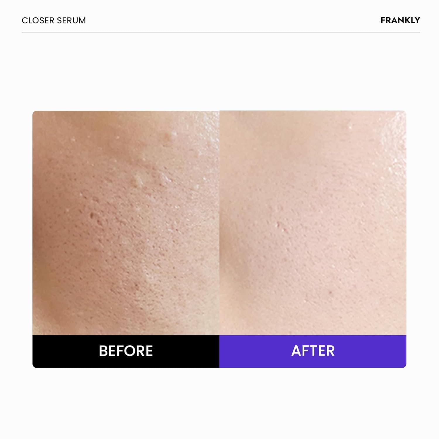 Closer Pore Reducing Serum 2