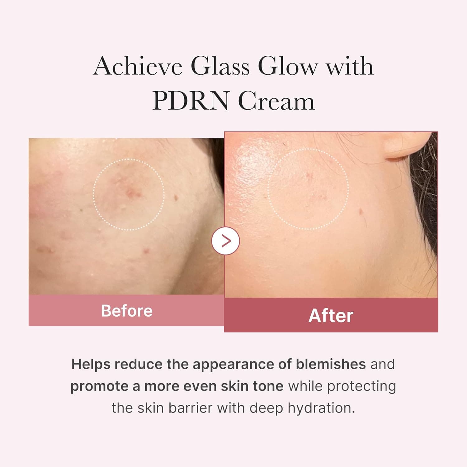 PDRN Pink Hyaluronic Moisturizing Cream 3