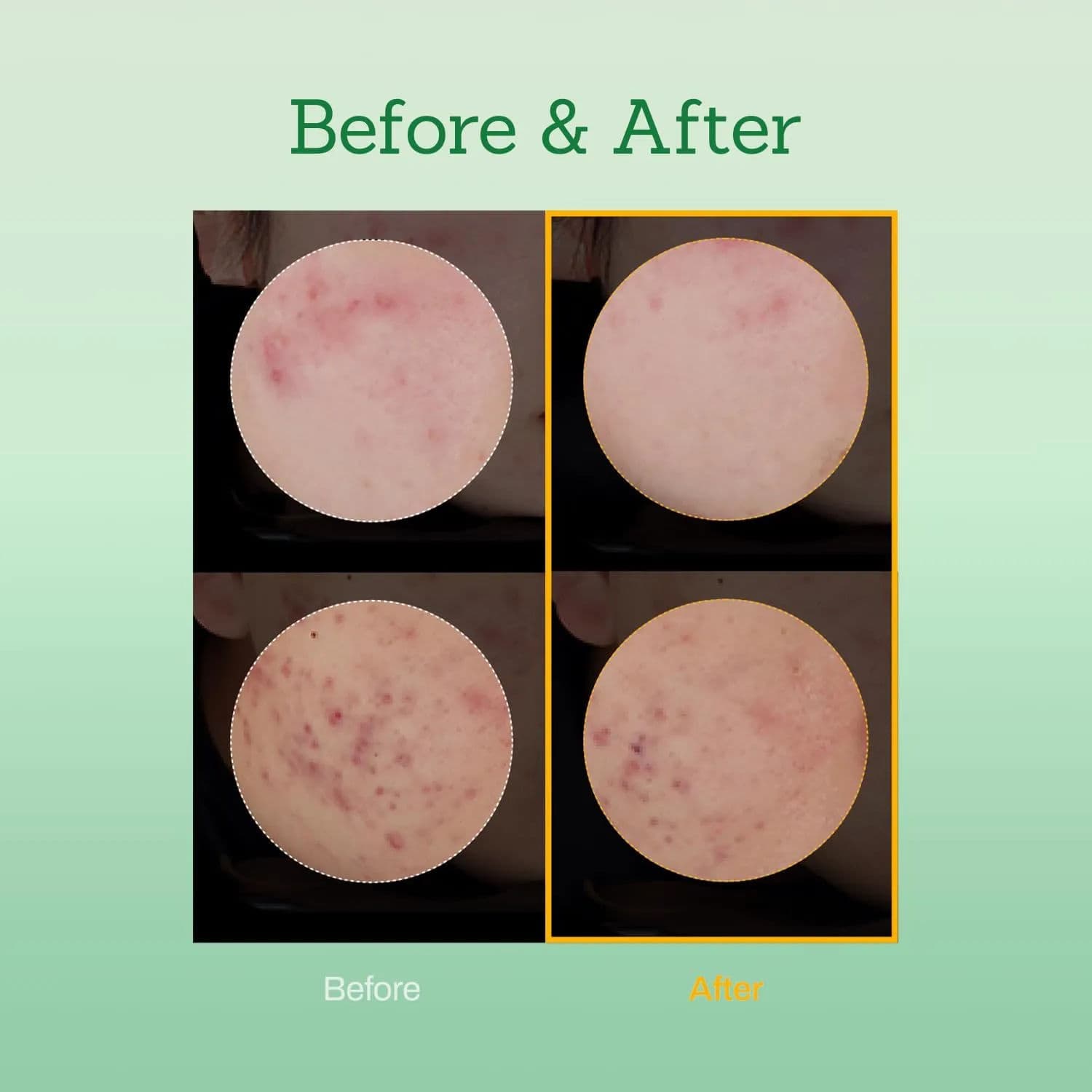 Mugwort Super Calming Toner 5