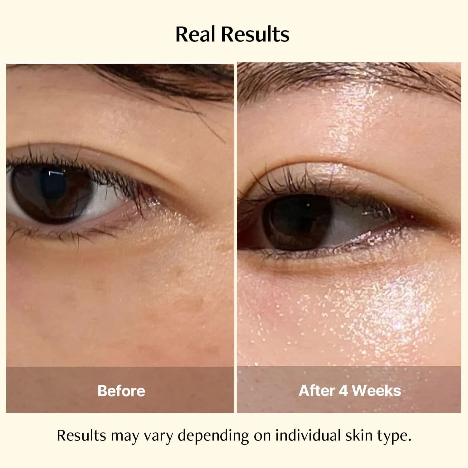 Vita Real Toning Laser Cream 4