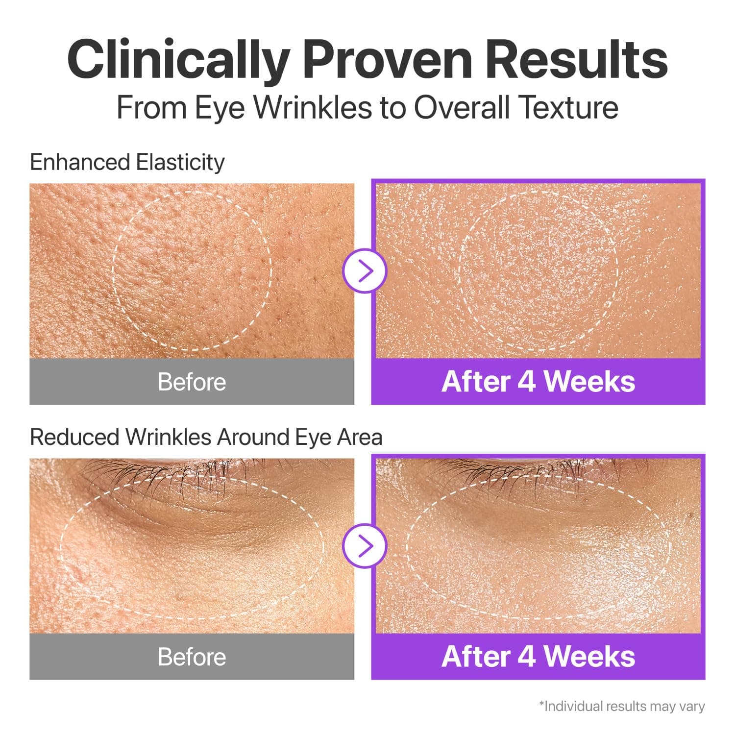 No.9 NAD Bio Lifting-sil Essence 5