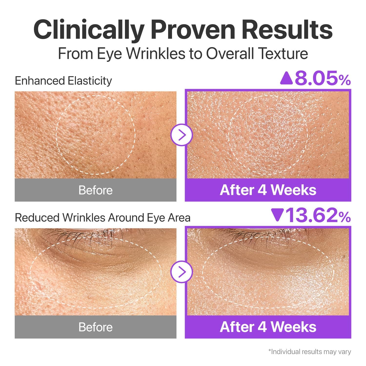 No.9 Essence + Mask Duo Set 5