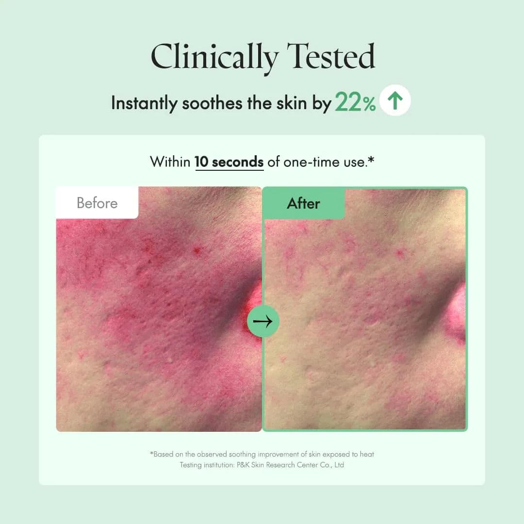 Wonder Releaf Centella Serum Unscented 5