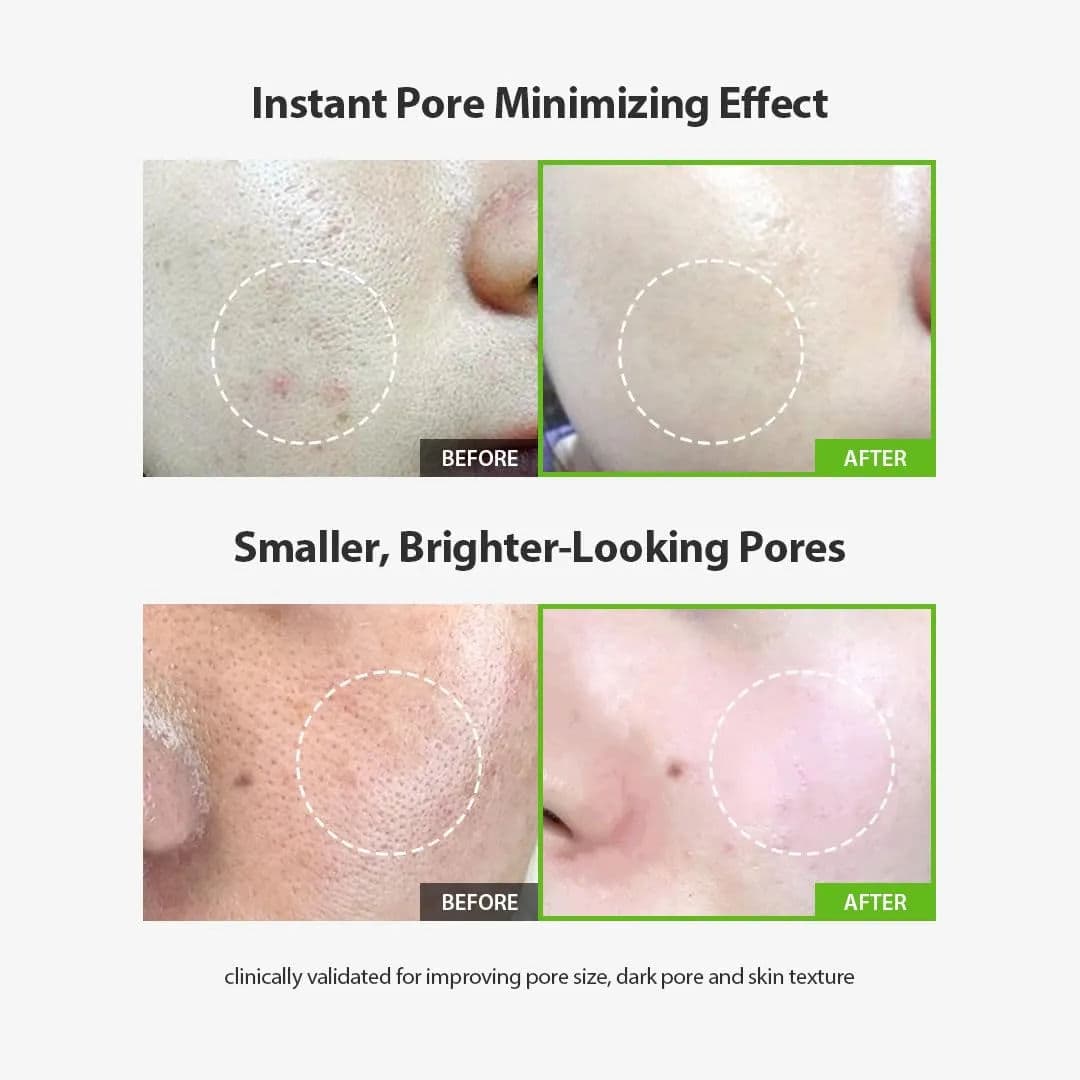 Green Tomato Pore Lifting Ampoule+ 2