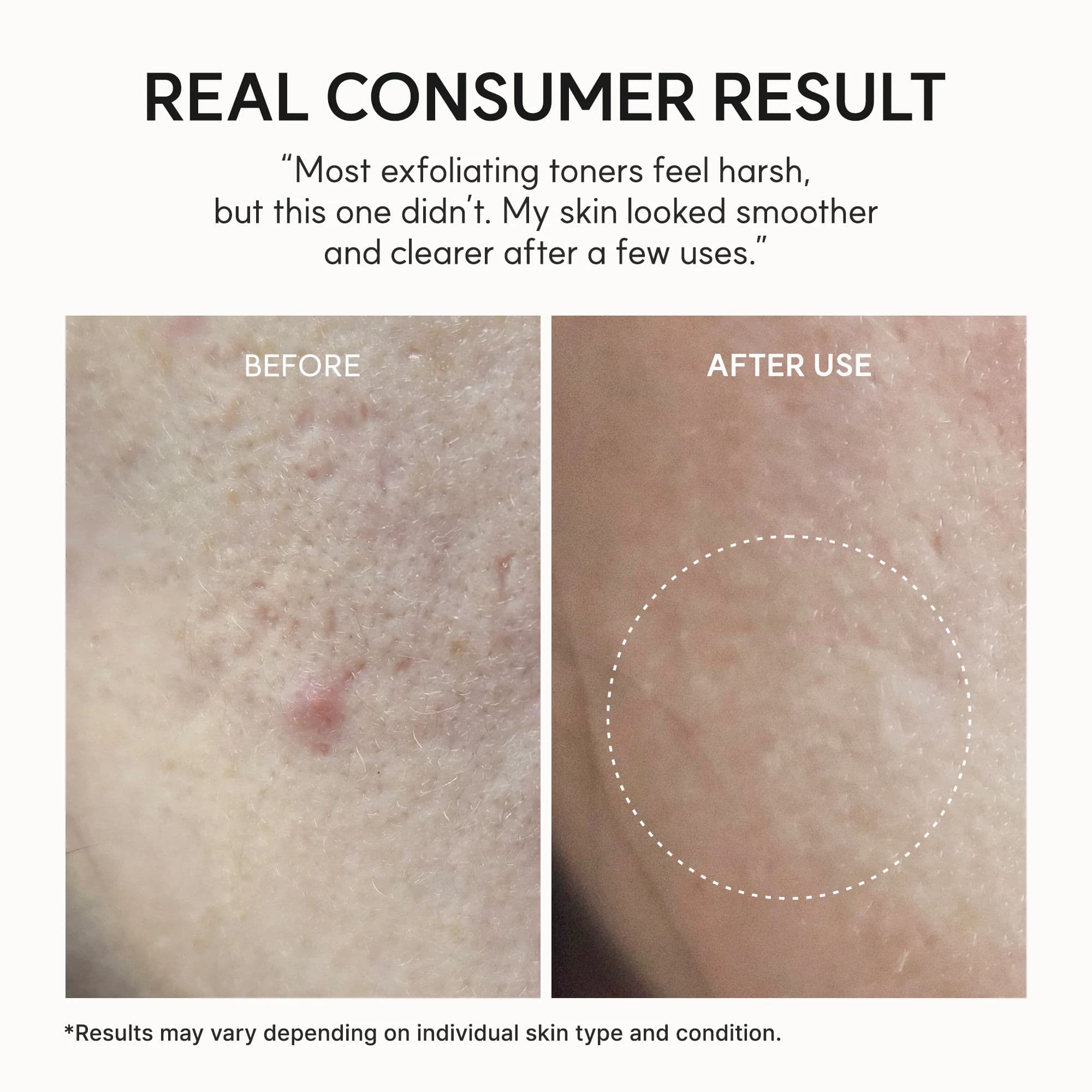 Eraser Shot Glycolic Acid Exfoliator 8