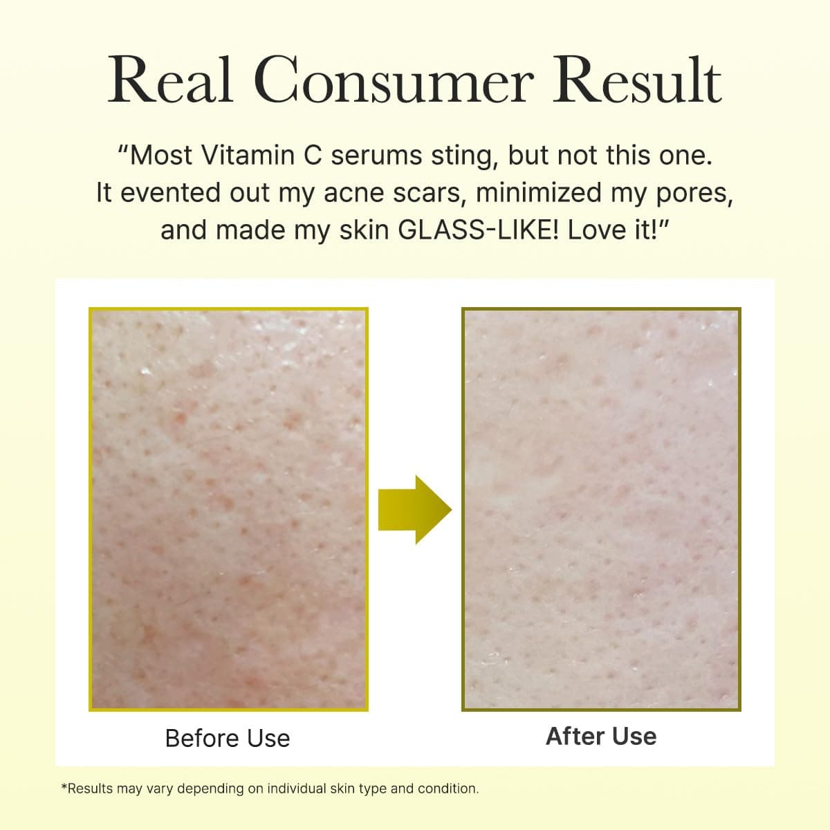 Vitamin C Booster Shot 7