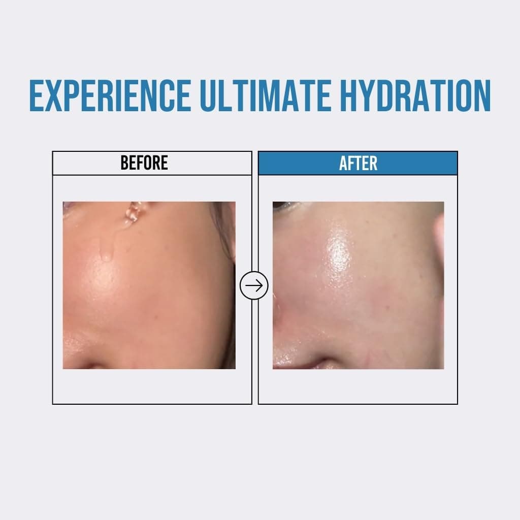 Waterfull Hyaluronic Acid Serum 3