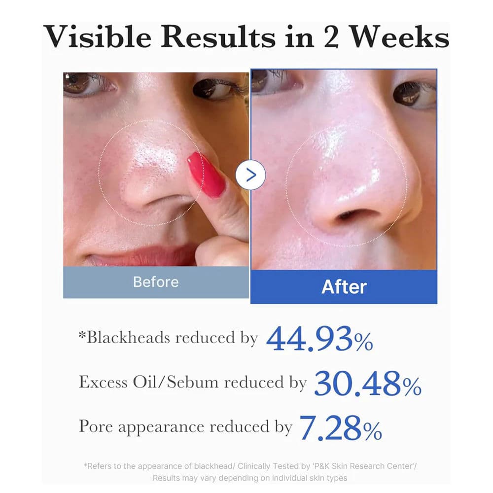 Zero Pore Pad 2.0 5